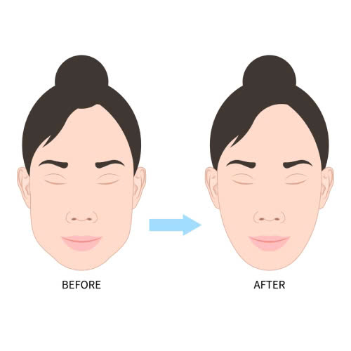 tiem-botox-gon-ham-bao-nhieu-cc-lieu-luong-chuan-cho-tung-co-dia