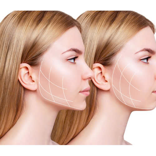 tiem-botox-gon-ham-gia-bao-nhieu-giai-dap-chi-tiet-truoc-khi-thuc-hien