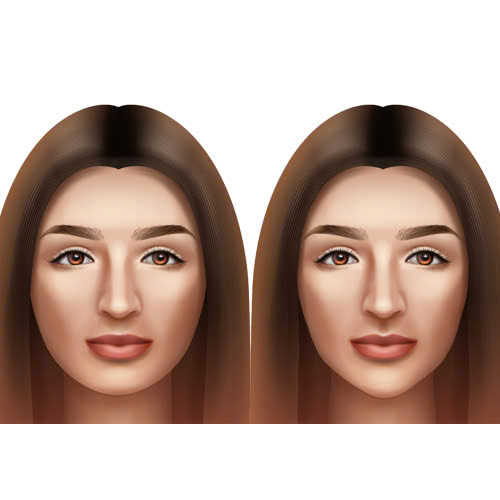 tiem-botox-gon-ham-giu-duoc-bao-lau-nhung-yeu-to-anh-huong-den-thoi-gian-duy-tri