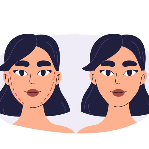 tiem-botox-gon-ham-giu-duoc-bao-lau-nhung-yeu-to-anh-huong-den-thoi-gian-duy-tri