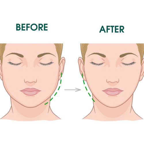 tiem-botox-gon-ham-o-dau-uy-tin-bi-quyet-lua-chon-dia-chi-an-toan