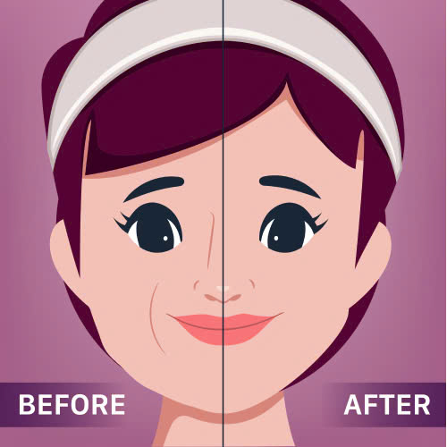 tiem-botox-khong-nen-an-gi-nhung-dieu-can-biet-de-hieu-qua-dep-nhu-mong-muon