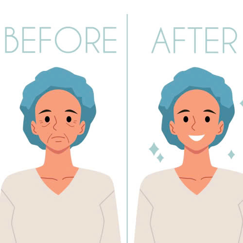 tiem-botox-kieng-gi-nhung-dieu-can-tranh-de-dat-hieu-qua-tot