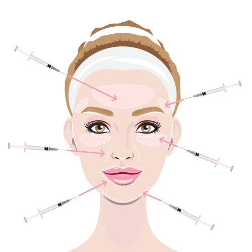 tiem-botox-kieng-gi-nhung-dieu-can-tranh-de-dat-hieu-qua-tot