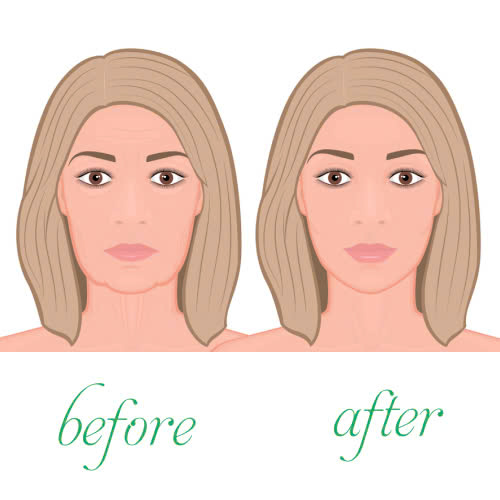 tiem-botox-sau-bao-lau-co-tac-dung-giai-dap-tat-tan-tat-cach-cham-soc-de-giu-duoc-ket-qua-lau-dai