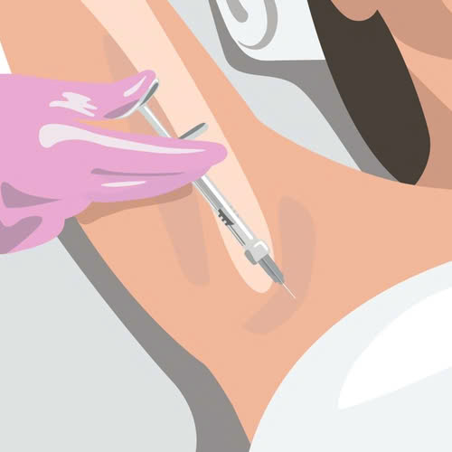 tiem-botox-tri-hoi-nach-co-hieu-qua-khong-su-that-khien-nhieu-nguoi-bat-ngo