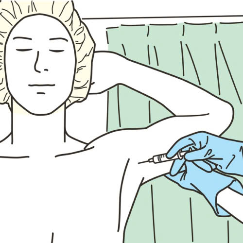 tiem-botox-tri-hoi-nach-gia-bao-nhieu-giai-phap-hieu-qua-de-loai-bo-mui-co-the