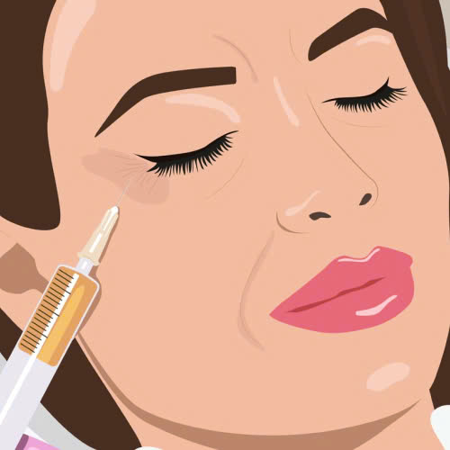 tiem-botox-xoa-nhan-duoi-mat-gia-bao-nhieu-giai-dap-chi-tiet-tat-tan-tat-ve-gia