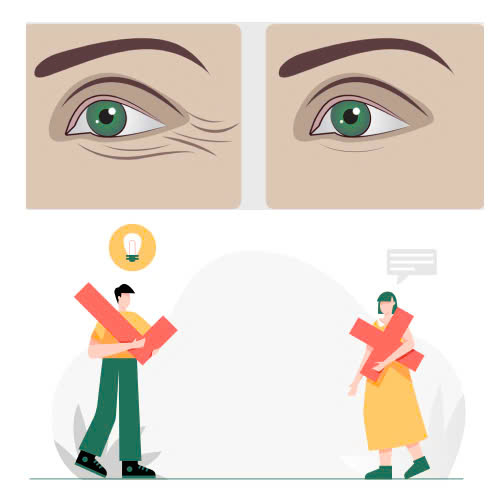 tiem-botox-xoa-nhan-duoi-mat-gia-bao-nhieu-giai-dap-chi-tiet-tat-tan-tat-ve-gia