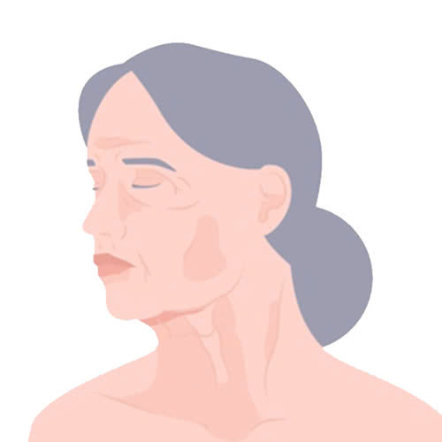 tiem-botox-xoa-nhan-gia-bao-nhieu-cap-nhat-chi-phi-moi-hien-nay