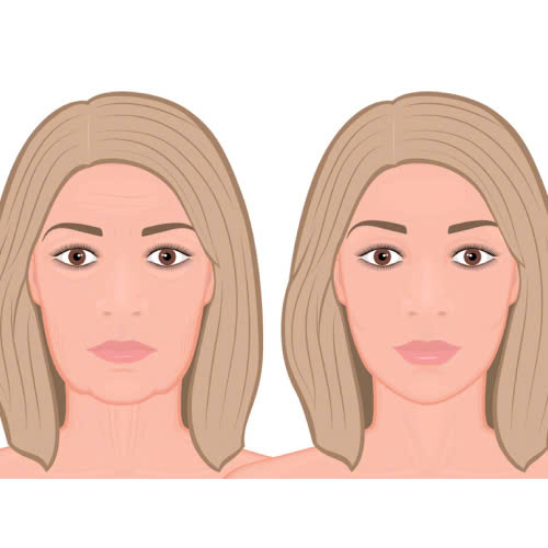 tiem-botox-xoa-nhan-giu-duoc-bao-lau-tat-ca-nhung-dieu-ban-can-biet