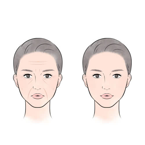 tiem-botox-xoa-nhan-giu-duoc-bao-lau-tat-ca-nhung-dieu-ban-can-biet