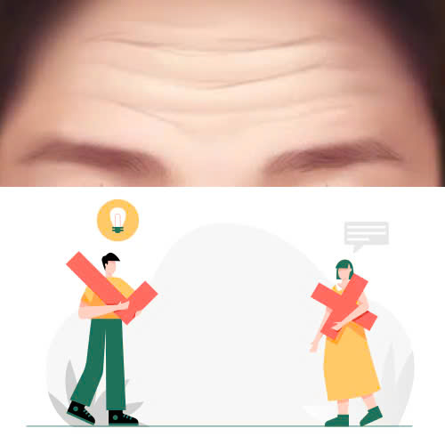 tiem-botox-xoa-nhan-tran-gia-bao-nhieu-cap-nhat-chi-tiet-moi