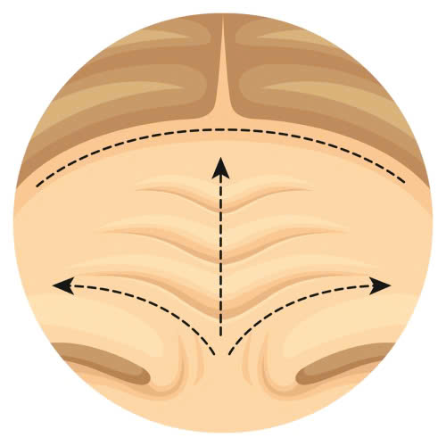 tiem-botox-xoa-nhan-tran-gia-bao-nhieu-cap-nhat-chi-tiet-moi