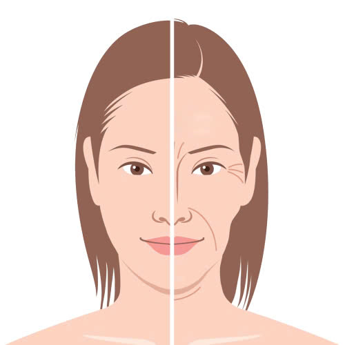 tiem-filler-an-ca-duoc-khong-kieng-bao-lau-la-tot