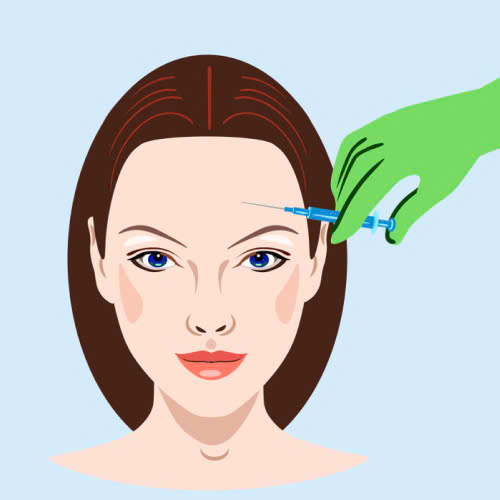 tiem-filler-an-ga-duoc-khong-su-that-ban-can-biet