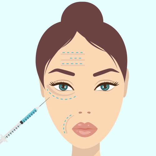 tiem-filler-an-ga-duoc-khong-su-that-ban-can-biet