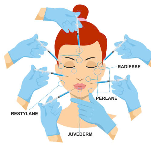 tiem-filler-an-oc-duoc-khong-nhung-dieu-can-biet-sau-khi-tiem-filler