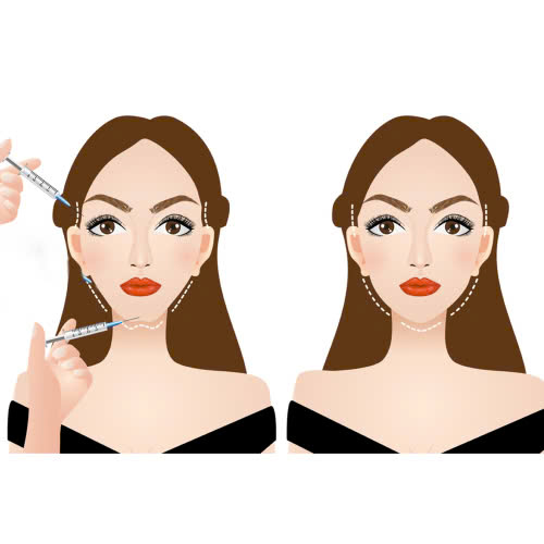 tiem-filler-an-trung-vit-lon-duoc-khong-doc-ngay-truoc-khi-qua-muon