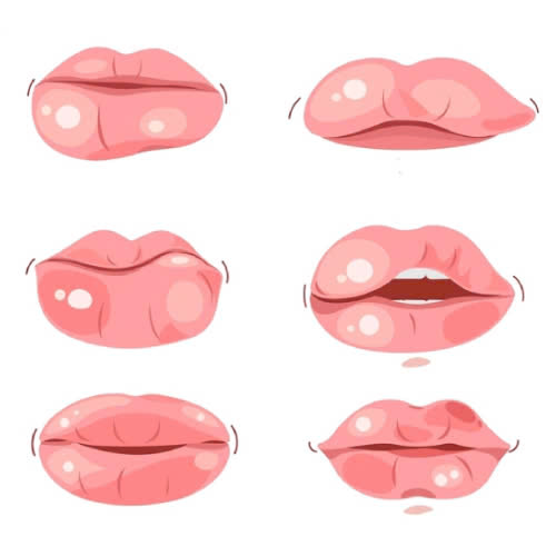 dau-hieu-tiem-filler-moi-hong-cach-nhan-biet-va-xu-ly-hieu-qua