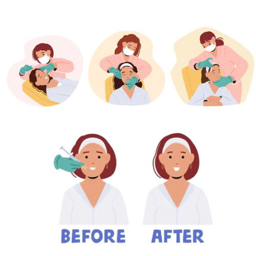 nhuoc-diem-cua-tiem-filler-nhung-dieu-ban-can-biet-truoc-khi-quyet-dinh