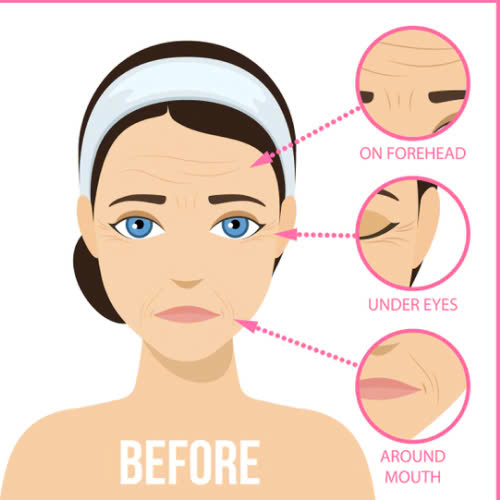 phan-ung-sau-khi-tiem-filler-dau-hieu-binh-thuong-va-nguy-hiem-can-luu-y