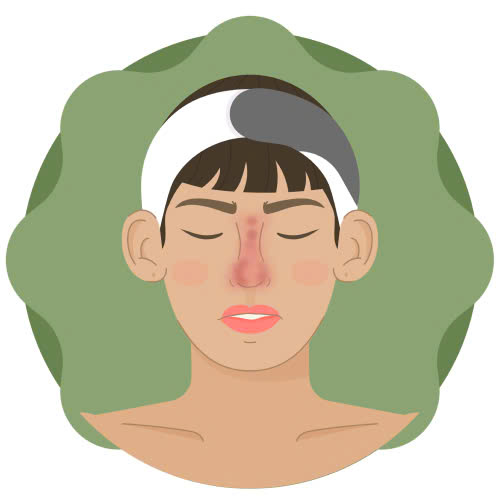 tai-sao-khong-nen-tiem-filler-mui-nhung-rui-ro-tiem-an-ban-can-biet