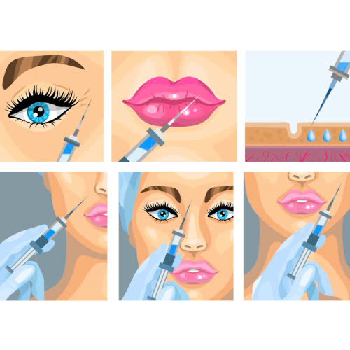 tiem-filler-5-nam-khong-tan-nguyen-nhan-hau-qua-va-cach-xu-ly