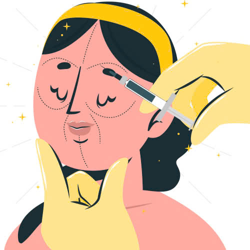 tiem-filler-bao-lau-thi-tan-giai-dap-tu-a-z