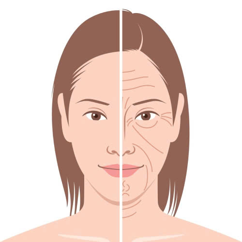 tiem-filler-co-bi-chay-xe-khong-giai-dap-chi-tiet-tu-chuyen-gia