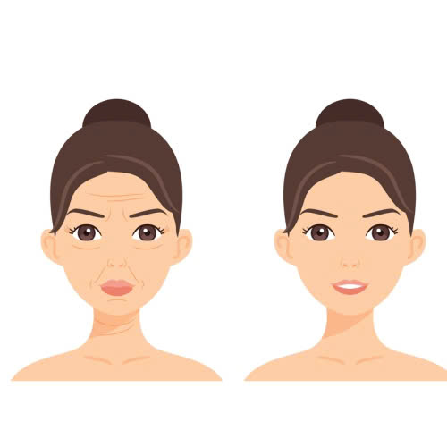tiem-filler-co-kieng-quan-he-khong-giai-dap-chi-tiet