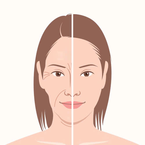 tiem-filler-co-peel-da-duoc-khong-giai-dap-chi-tiet-thac-mac-cua-ban