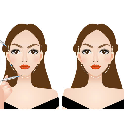 tiem-filler-lau-dai-co-anh-huong-gi-khong-nhung-dieu-can-biet-truoc-khi-thuc-hien