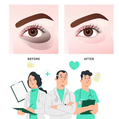 tiem-filler-quang-tham-mat-gia-bao-nhieu-giai-dap-chi-tiet-va-nhung-dieu-can-biet