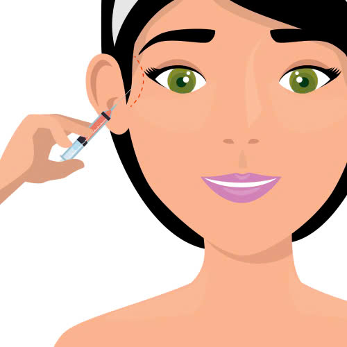 tiem-filler-thai-duong-co-an-toan-khong-giai-dap-chi-tiet