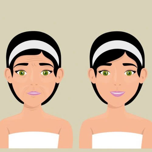 tiem-filler-uong-cafe-duoc-khong-nhung-dieu-can-tranh-khi-tiem-filler