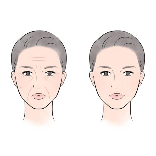 tiem-filler-uong-khang-sinh-co-sao-khong-giai-dap-chi-tiet