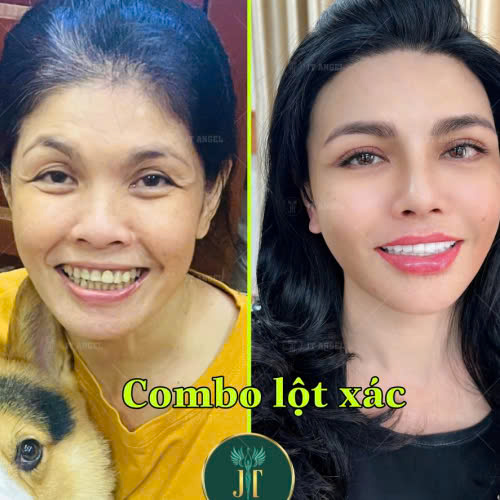 cang-da-mat-bao-nhieu-tien-bang-gia-moi-va-nhung-dieu-can-biet