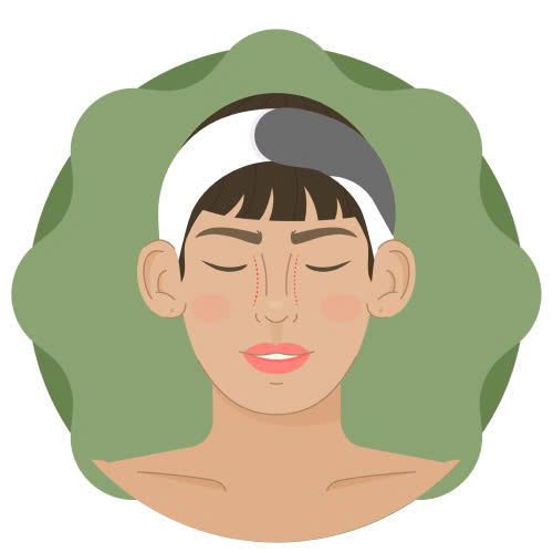 mai-xuong-be-mui-co-dau-khong-giai-dap-tu-a-z-cho-nguoi-chuan-bi-phau-thuat