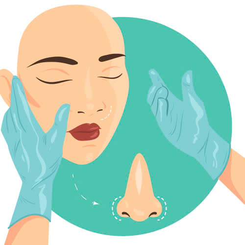 can-chinh-canh-mui-khong-phau-thuat-bi-quyet-so-huu-dang-mui-thon-gon-khong-can-dao-keo