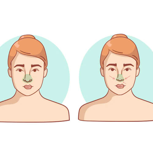 can-chinh-canh-mui-la-gi-giai-phap-tham-my-giup-guong-mat-hai-hoa-va-thanh-thoat-hon