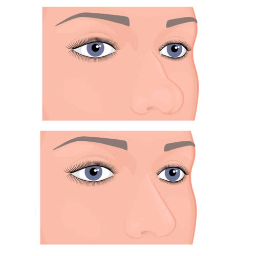 cay-trung-bi-mo-mui-co-can-su-dung-thuoc-gi-khong-nhung-luu-y-quan-trong-ban-can-phai-biet