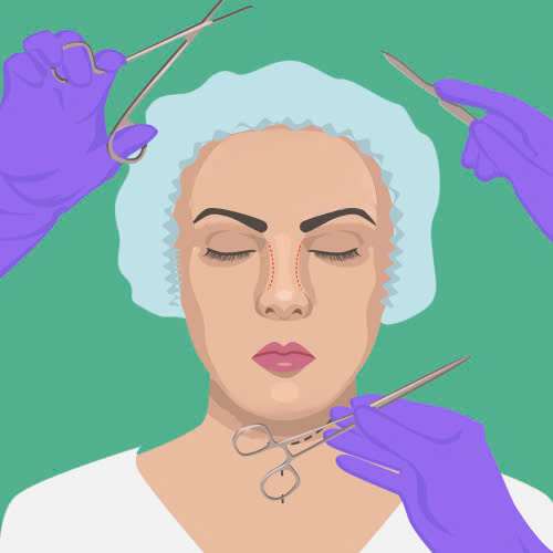 mai-xuong-be-mui-co-can-gay-me-khong-tu-van-chi-tiet-cho-nguoi-lan-dau-thuc-hien