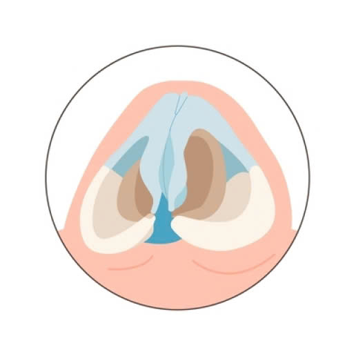 mo-rong-lo-mui-bao-lau-thi-lanh-giai-dap-chi-tiet-cho-nguoi-lan-dau-tham-my