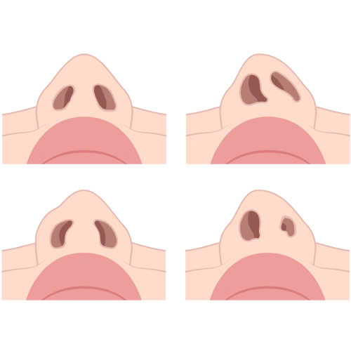 mo-rong-lo-mui-bao-lau-thi-lanh-giai-dap-chi-tiet-cho-nguoi-lan-dau-tham-my