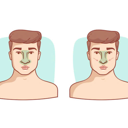 nang-nen-canh-mui-giu-duoc-bao-lau-so-sanh-cac-phuong-phap-pho-bien-hien-nay