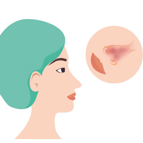 bi-quyet-cham-soc-hieu-qua-nao-silicone-mui-co-can-nghi-duong-khong