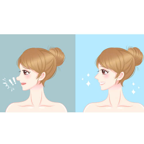 nao-silicone-mui-co-dau-khong-nhung-dieu-ai-cung-nen-biet-truoc-khi-quyet-dinh