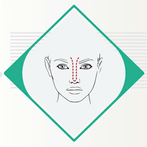 nao-silicone-mui-co-ket-hop-voi-nang-mui-khong