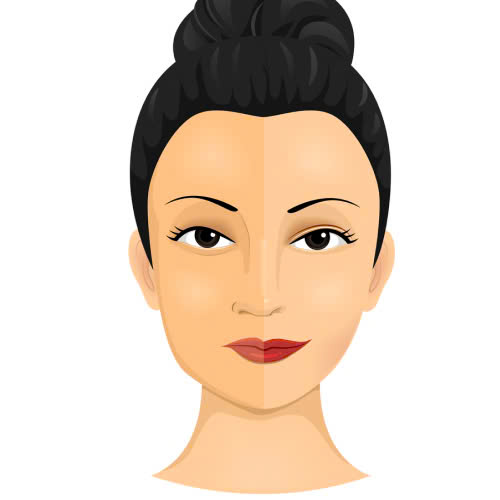 top-5-dieu-can-biet-truoc-khi-thuc-hien-phau-thuat-can-chinh-canh-mui